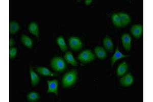 Immunofluorescent analysis of A549 cells using ABIN7163201 at dilution of 1:100 and Alexa Fluor 488-congugated AffiniPure Goat Anti-Rabbit IgG(H+L) (PIP4K2B antibody  (AA 1-270))