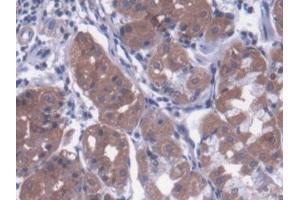 DAB staining on IHC-P; Samples: Human Stomach Tissue (Metaxin 1 antibody  (AA 175-387))