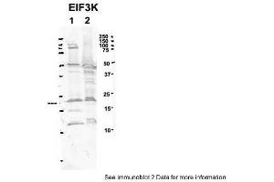 Sample Type: 1. (EIF3K antibody  (C-Term))