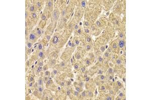 Immunohistochemistry of paraffin-embedded Human liver injury using PEX5 antibody at dilution of 1:100 (x400 lens).