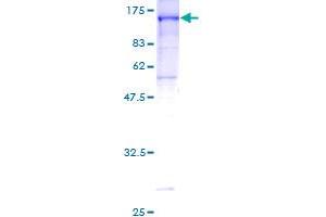 CNKSR1 Protein (AA 1-720) (GST tag)