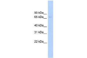 Human HepG2; WB Suggested Anti-ABCF2 Antibody Titration: 0. (ABCF2 antibody  (Middle Region))