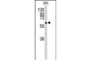Western blot analysis of CDC73 Antibody (Center) (ABIN653128 and ABIN2842707) in 293 cell line lysates (35 μg/lane).