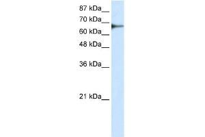 WB Suggested Anti-L3MBTL2 Antibody Titration: 0. (L3MBTL2 antibody  (C-Term))