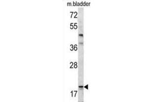 Western Blotting (WB) image for anti-BCL2-Associated Agonist of Cell Death (BAD) (BH3 Domain) antibody (ABIN2997223) (BAD antibody  (BH3 Domain))