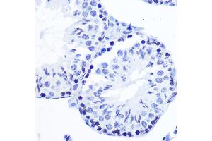 Immunohistochemistry of paraffin-embedded mouse testis using Phospho-SMC1-S957 Rabbit mAb (ABIN7270613) at dilution of 1:100 (40x lens). (SMC1A antibody  (pSer957))