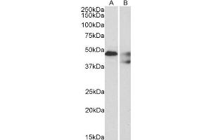 ABIN185637 (1µg/ml) staining of Human Cerebellum (A) and Mouse spinal cord (B) lysates (35µg protein in RIPA buffer). (5HT1B Receptor antibody  (C-Term))