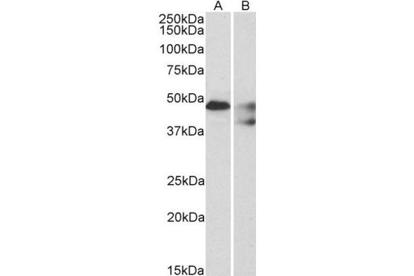 5HT1B Receptor antibody  (C-Term)