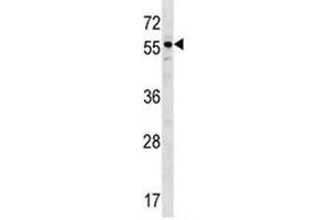 BMP3 antibody western blot analysis in ZR-75-1 lysate. (BMP3 antibody  (AA 318-347))