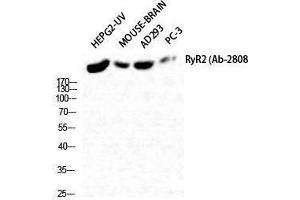 Western Blotting (WB) image for anti-Ryanodine Receptor 2 (Cardiac) (RYR2) (Tyr1018) antibody (ABIN3177320) (RYR2 antibody  (Tyr1018))