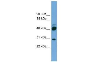 Western Blot showing PRR5 antibody used at a concentration of 1-2 ug/ml to detect its target protein.