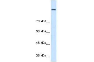 AOC2 antibody (retina specific) used at 1 ug/ml to detect target protein.