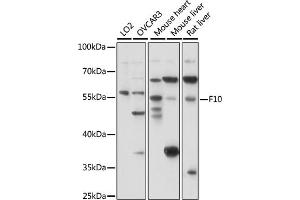 Western blot analysis of extracts of various cell lines, using F10 antibody (ABIN7266422) at 1:1000 dilution. (Coagulation Factor X antibody  (AA 41-300))