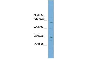 WB Suggested Anti-RPAIN Antibody Titration:  0.