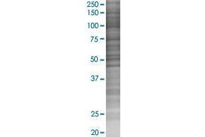 DENND5A transfected lysate. (RAB6IP1 293T Cell Transient Overexpression Lysate(Denatured))