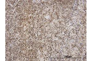 Image no. 1 for anti-Tankyrase, TRF1-Interacting Ankyrin-Related ADP-Ribose Polymerase (TNKS) (AA 1017-1125) antibody (ABIN599052) (TNKS antibody  (AA 1017-1125))