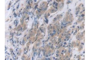 Immunohistochemistry (IHC) image for anti-C-Reactive Protein (CRP) (AA 17-224) antibody (ABIN7442345)