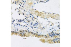 Immunohistochemistry of paraffin-embedded mouse lung using CLIP1 antibody.
