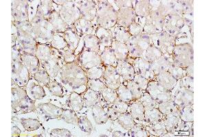 Formalin-fixed and paraffin embedded human colon carcinoma tissue labeled with Rabbit Anti-RAB7 Polyclonal Antibody at 1:200 followed by conjugation to the secondary antibody and DAB staining. (RAB7A antibody  (AA 101-207))