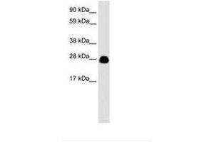 Image no. 3 for anti-14-3-3 eta (YWHAH) (AA 72-121) antibody (ABIN6735931) (14-3-3 eta antibody  (AA 72-121))