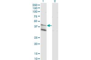 Western Blotting (WB) image for anti-Ceramide Synthase 4 (CERS4) (AA 57-139) antibody (ABIN566360)