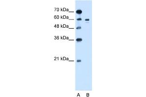 WB Suggested Anti-TYR Antibody Titration:  1. (TYR antibody  (Middle Region))