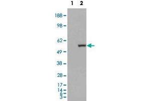 HEK293 overexpressing ALDH1A1 and probed with ALDH1A1 polyclonal antibody  (mock transfection in first lane), tested by Origene. (ALDH1A1 antibody  (C-Term))