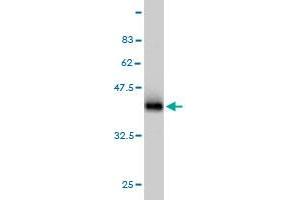 Western Blotting (WB) image for anti-RAB8A, Member RAS Oncogene Family (RAB8A) (AA 108-207) antibody (ABIN561805)