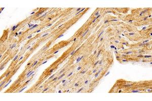 Detection of BMP2 in Rat Cardiac Muscle Tissue using Polyclonal Antibody to Bone Morphogenetic Protein 2 (BMP2) (BMP2 antibody  (AA 49-243))