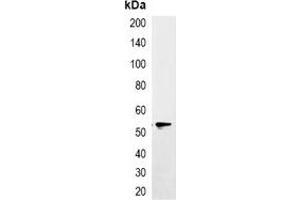 Immunoprecipitation of EYFP-tagged protein from HEK293T cells transfected with vector overexpressing EYFP tag, using Anti-EYFP-tag Antibody. (eYFP antibody)