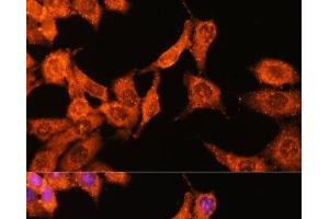 Immunofluorescence analysis of HeLa cells using N-WASP Polyclonal Antibody at dilution of 1:100 (40x lens).