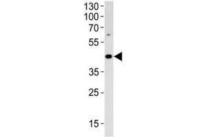 ADA antibody western blot analysis in HL-60 lysate (ADA antibody  (AA 287-314))