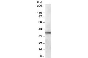 Western blot testing of human lung lysate with PDLIM1 antibody at 0. (PDLIM1 antibody)