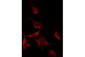 ABIN6268845 staining NIH-3T3 by IF/ICC. (NRF1 antibody  (Internal Region))