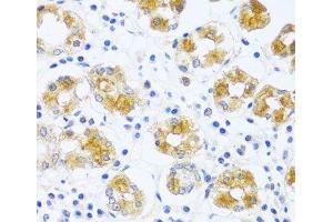Immunohistochemistry of paraffin-embedded Human stomach using BRK1 Polyclonal Antibody at dilution of 1:100 (40x lens). (BRK1 antibody)
