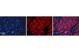 Rabbit Anti-ADH1B Antibody   Formalin Fixed Paraffin Embedded Tissue: Human heart Tissue Observed Staining: Cytoplasmic Primary Antibody Concentration: N/A Other Working Concentrations: 1:600 Secondary Antibody: Donkey anti-Rabbit-Cy3 Secondary Antibody Concentration: 1:200 Magnification: 20X Exposure Time: 0.