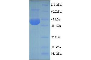 SDS-PAGE (SDS) image for NADPH Oxidase 4 (NOX4) (AA 210-424), (Extracellular) protein (His-SUMO Tag) (ABIN5713704) (NADPH Oxidase 4 Protein (NOX4) (AA 210-424, Extracellular) (His-SUMO Tag))