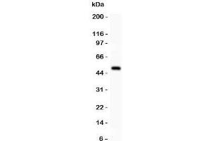 Western blot testing of alpha Catenin antibody and recombinant human protein (0. (CTNNA1 antibody  (AA 143-292))