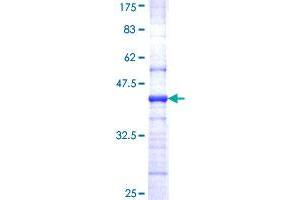 EIF4A2 Protein (AA 1-100) (GST tag)