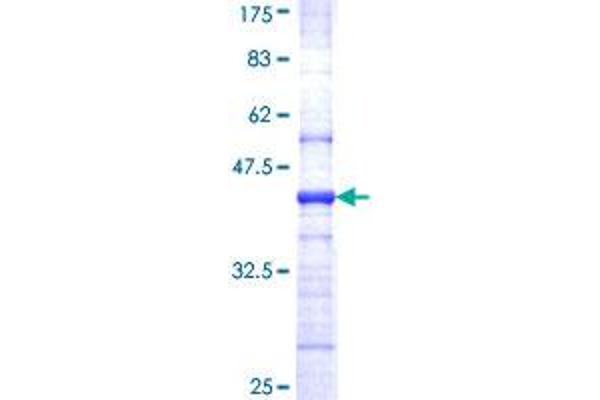 EIF4A2 Protein (AA 1-100) (GST tag)