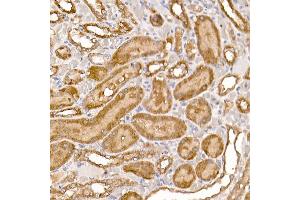Immunohistochemistry (IHC) image for anti-Numb Homolog (NUMB) (AA 521-640) antibody (ABIN6144943)