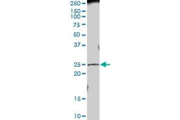 PRTFDC1 antibody  (AA 1-225)