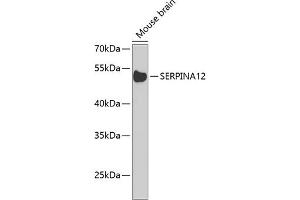 Western blot analysis of extracts of mouse brain, using SERPIN Antibody  at 1:1000 dilution. (SERPINA12 antibody  (AA 20-320))