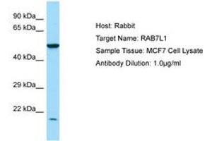Image no. 1 for anti-RAB7, Member RAS Oncogene Family-Like 1 (RAB7L1) (N-Term) antibody (ABIN6750021) (RAB7L1 antibody  (N-Term))