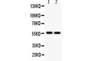 Anti- ALDH2  Picoband antibody, Western blottingAll lanes: Anti ALDH2  at 0. (ALDH2 antibody  (N-Term))