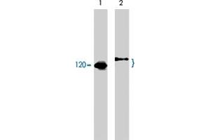 Western blot analysis of human Jurkat cells untreated (lane 1) or treated with pervanadate (1 mM) for 30 minutes (lane 2). (CBL antibody  (C-Term))