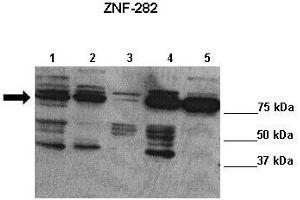 Lanes : Lane 1: 20ug Bewo cells Lane 2: 20ug HEK cells Lane 3: 20ug JEG3 cells Lane 4: 20ug PC3 cells Lane 5: 20ug SHEP cells  Primary Antibody Dilution :  1:1000   Secondary Antibody : Anti-rabbit-HRP  Secondary Antibody Dilution :  1:7500  Gene Name : ZNF282  Submitted by : Lisa Stubbs, University of Illinois (ZNF282 antibody  (C-Term))