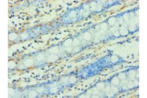 Immunohistochemistry of paraffin-embedded human colon tissue using ABIN7166295 at dilution of 1:100 (WNT2 antibody  (AA 26-360))