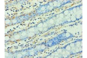 Immunohistochemistry of paraffin-embedded human colon tissue using ABIN7166295 at dilution of 1:100 (WNT2 antibody  (AA 26-360))