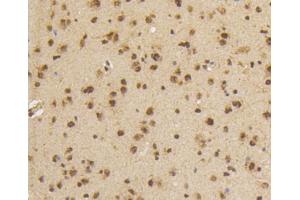 Paraformaldehyde-fixed, paraffin embedded mouse brain, Antigen retrieval by boiling in sodium citrate buffer (pH6) for 15min, Block endogenous peroxidase by 3% hydrogen peroxide for 30 minutes, Blocking buffer at 37°C for 20min, Antibody incubation with Smad5(S463/465) (1B8) Monoclonal Antibody  at 1:50 overnight at 4°C, followed by a conjugated secondary and DAB staining. (SMAD5 antibody  (pSer463, pSer465))